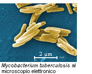 My. tuberculosis